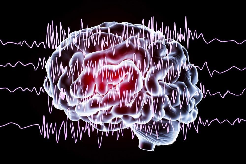 Qué son los Potenciales evocados somatosensoriales
