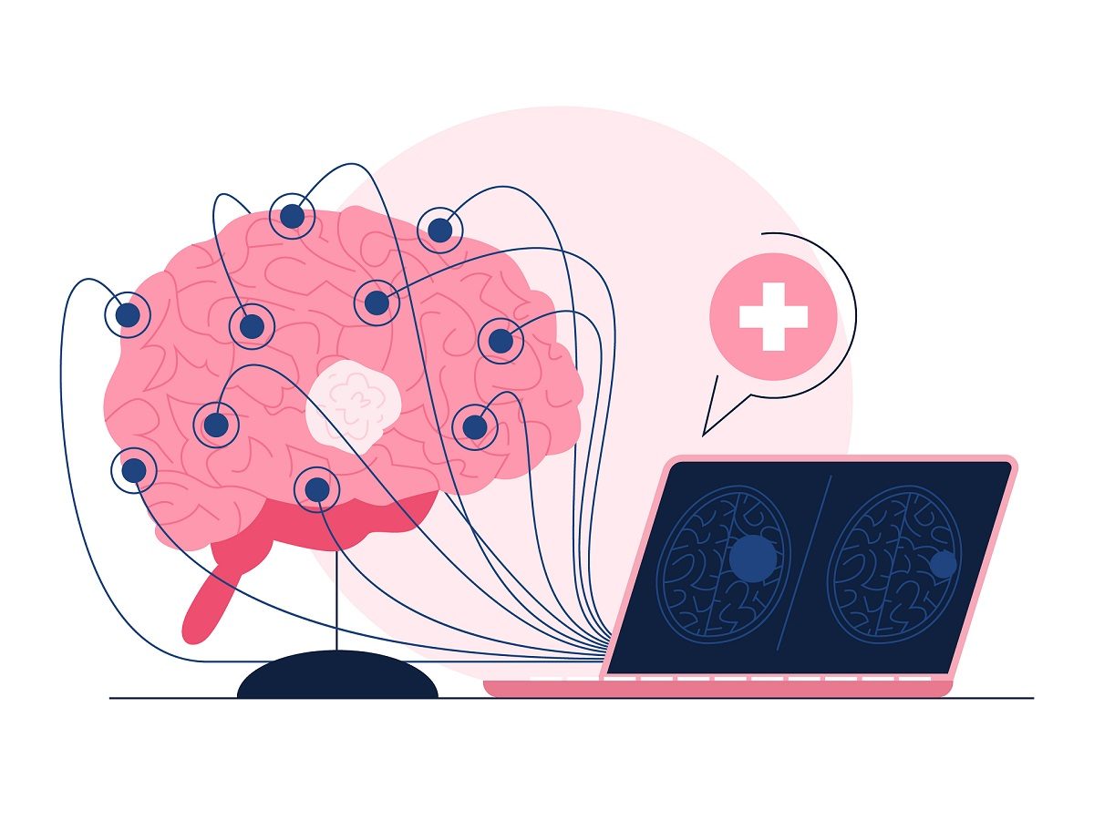 Dibujo sobre un cerebro en el estudio de electroencefalograma