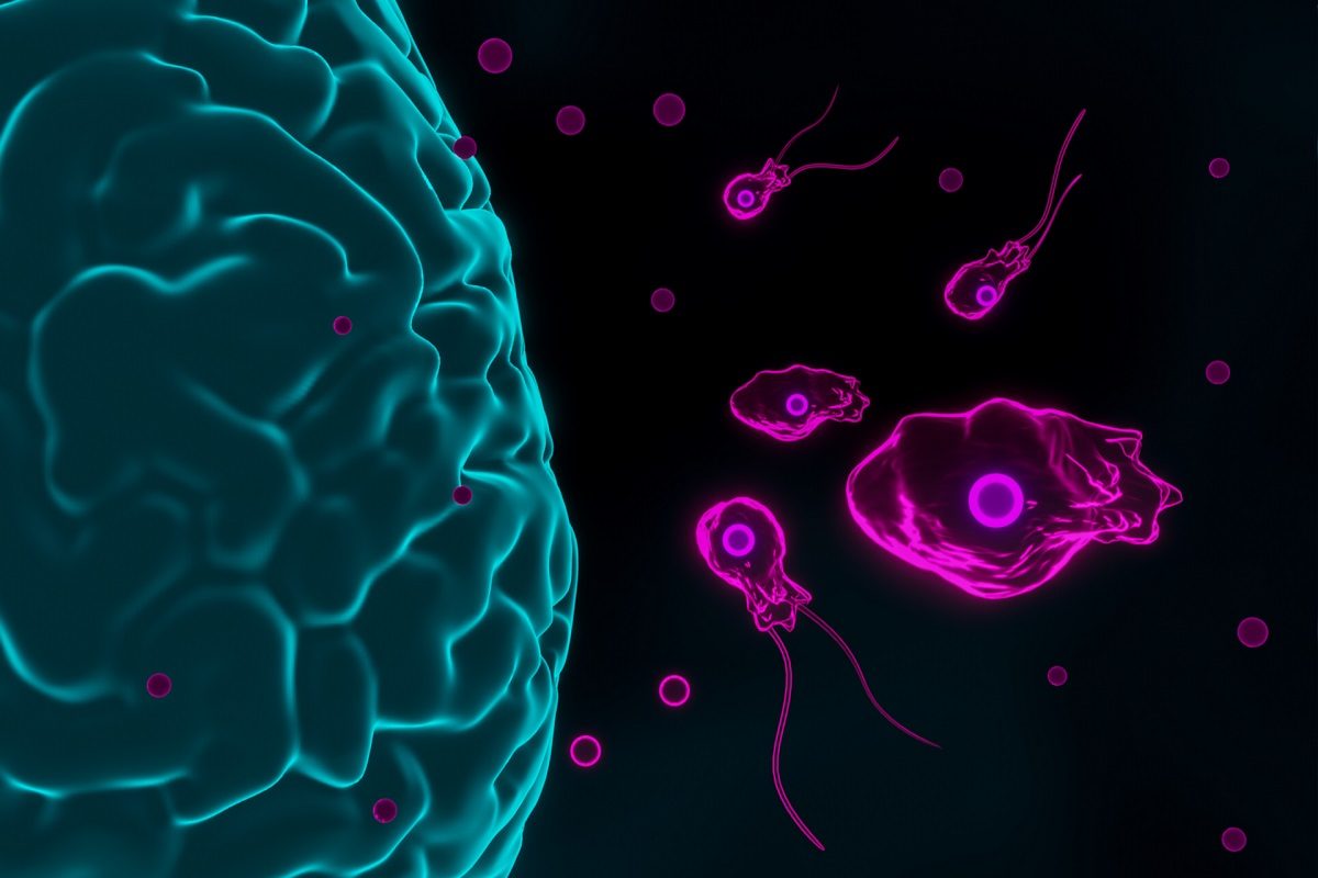 Ilustración de una infección en el cerebro